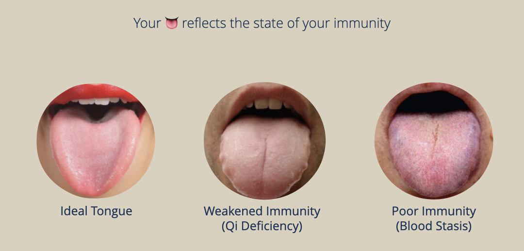Tongue test for state of immunity